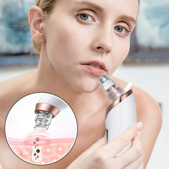 Aspirateur Points Noirs