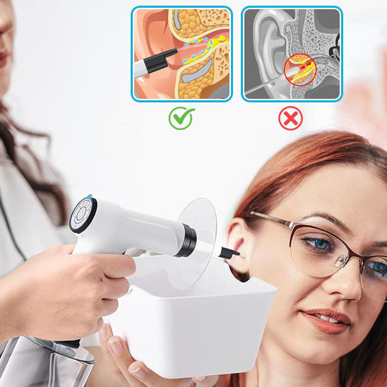 Nettoyage Électrique pour les Oreille