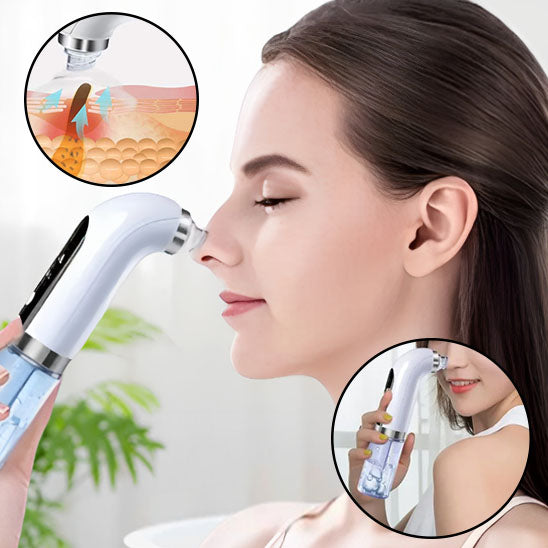 Aspirateur de Point Noir