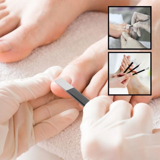 Emsemble Râpe pour pieds