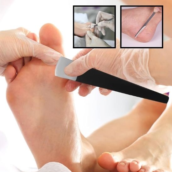 Emsemble Râpe pour pieds